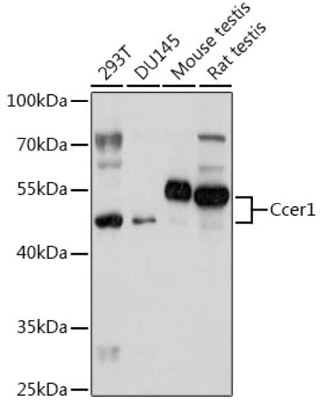 100UL CCER1 ANTIBODY 100 ul