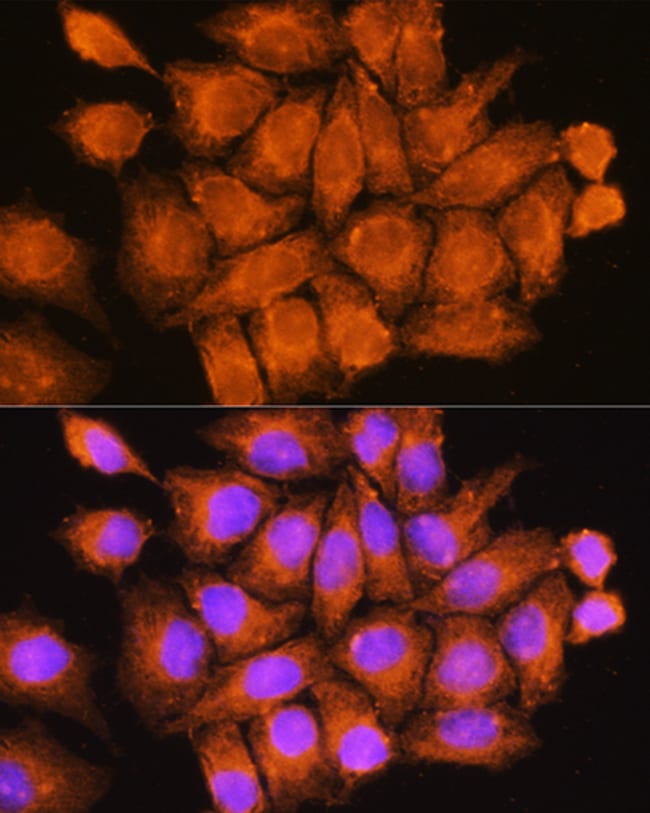 100UL CCDC11 ANTIBODY 100 ul