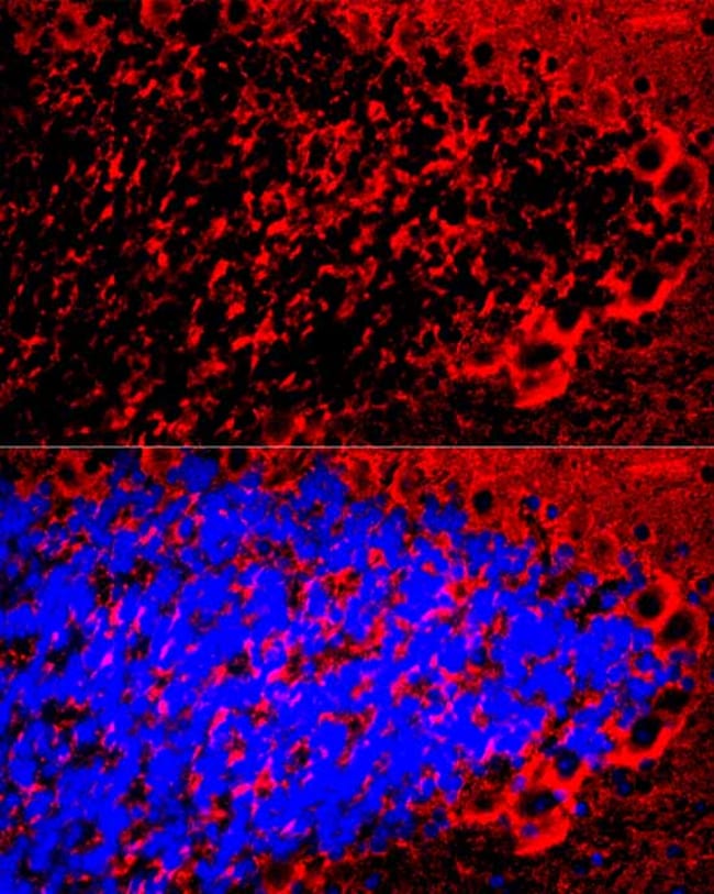 100UL MBP ANTIBODY 100 ul