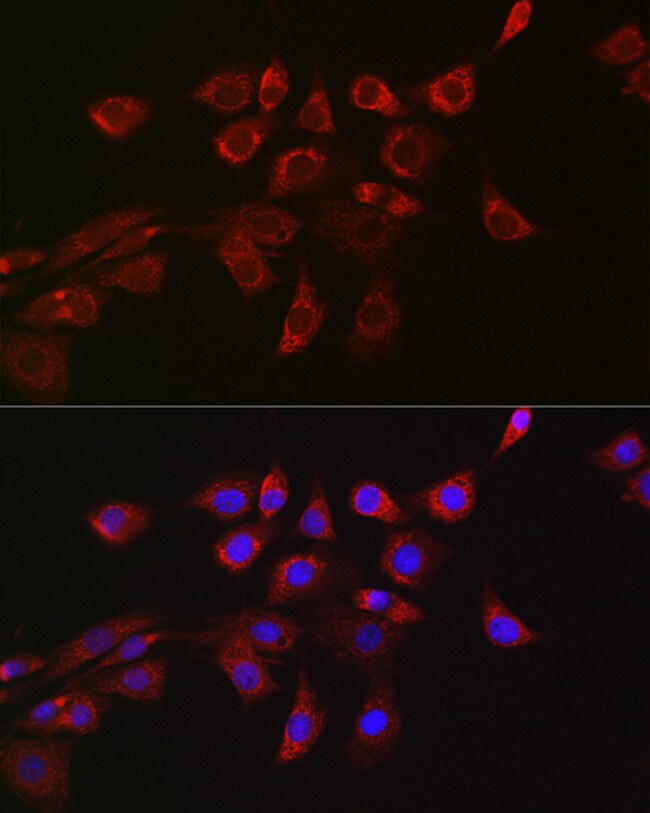 100UL DNM1L ANTIBODY 100 ul