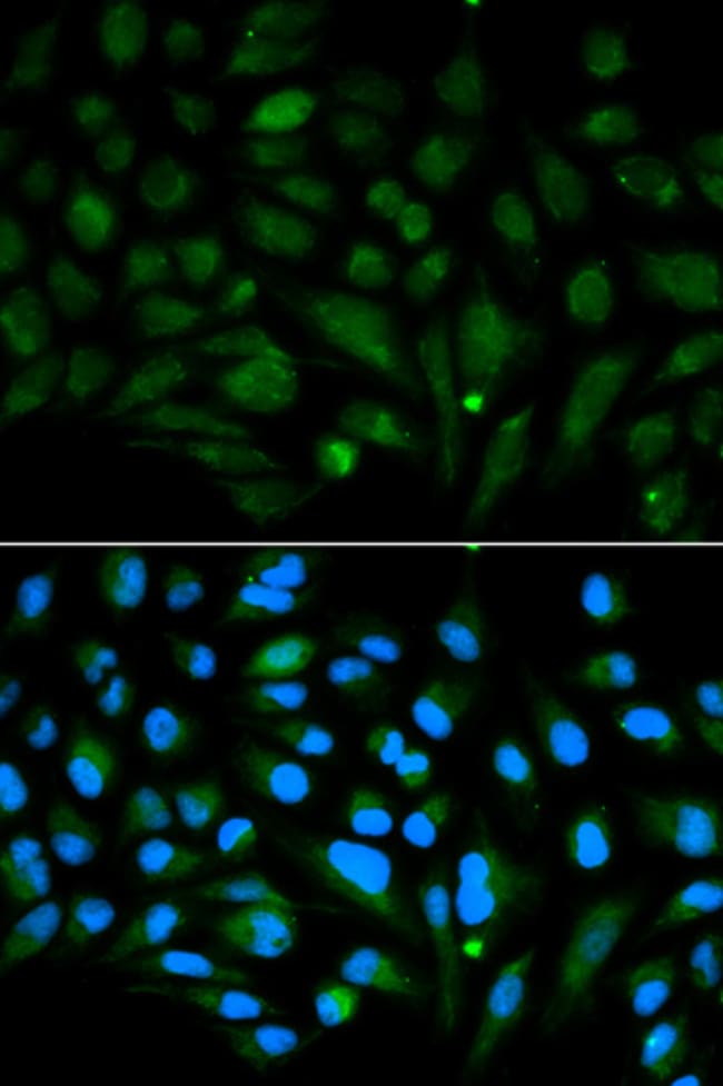 100UL DECORIN ANTIBODY 100 ul