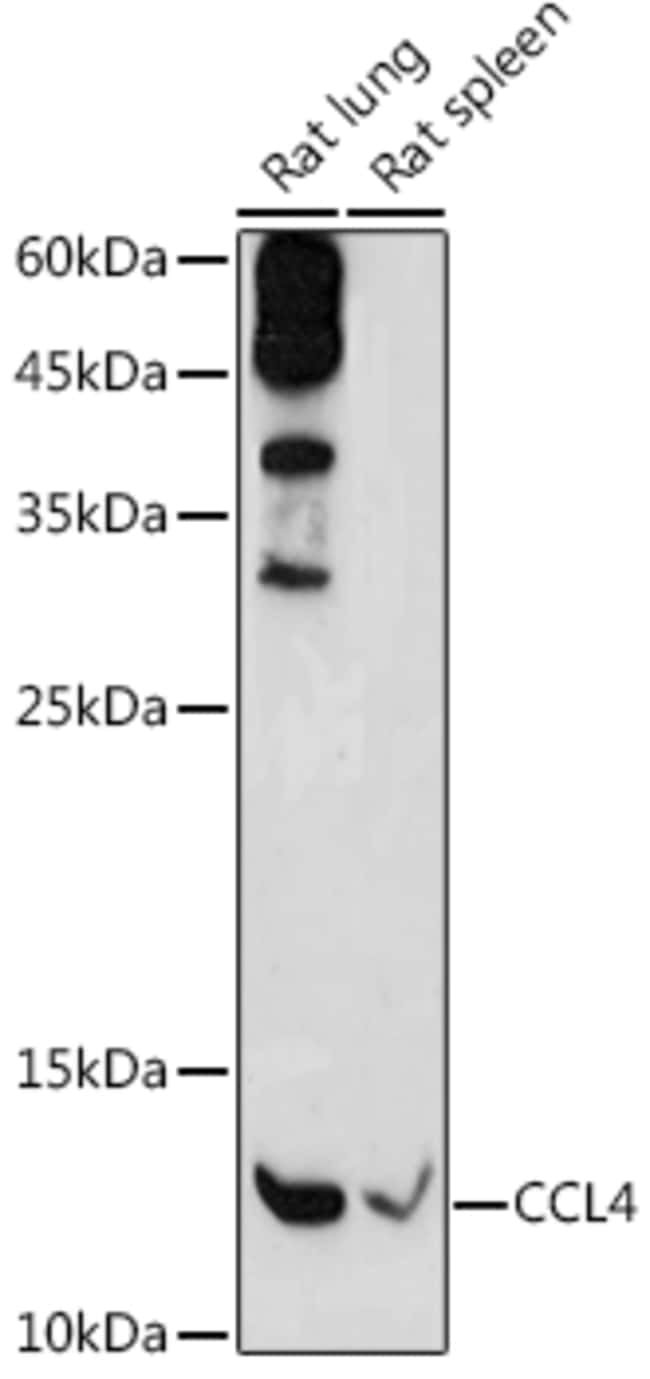 100UL CCL4 ANTIBODY 100 ul