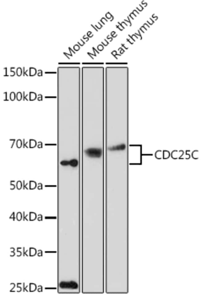 100UL CDC25C ANTIBODY 100 ul