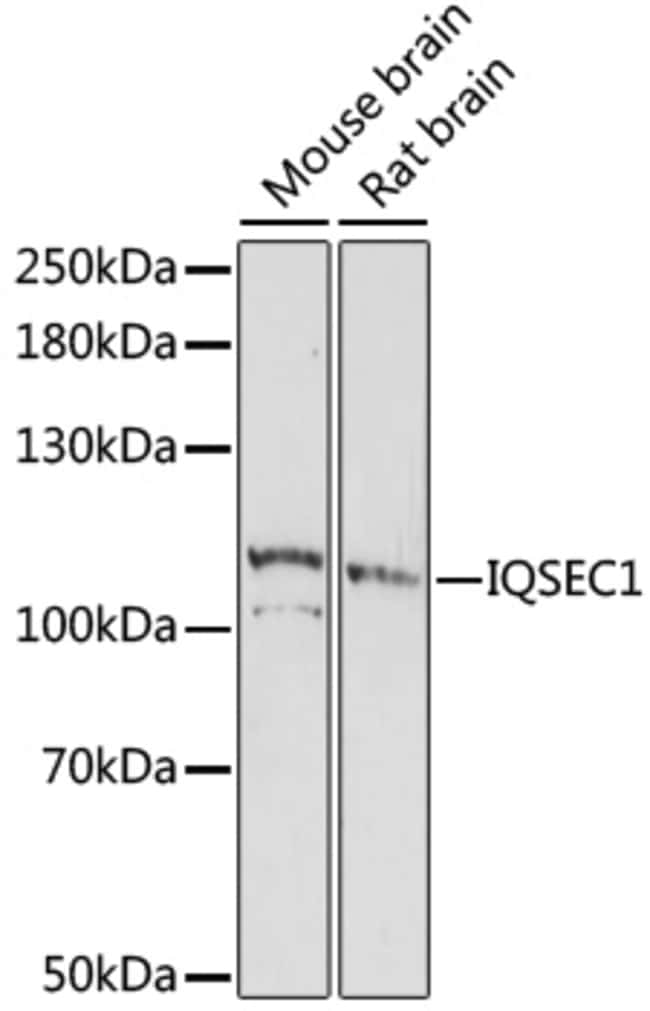 100UL IQSEC1 ANTIBODY 100 ul