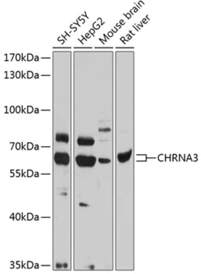 100UL CHRNA3 ANTIBODY 100 ul