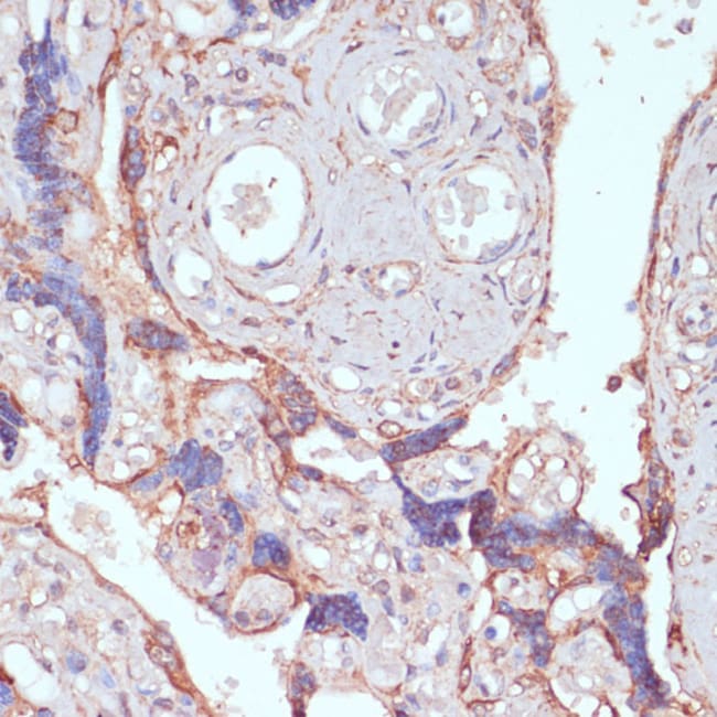 100UL ARL4D ANTIBODY 100 ul
