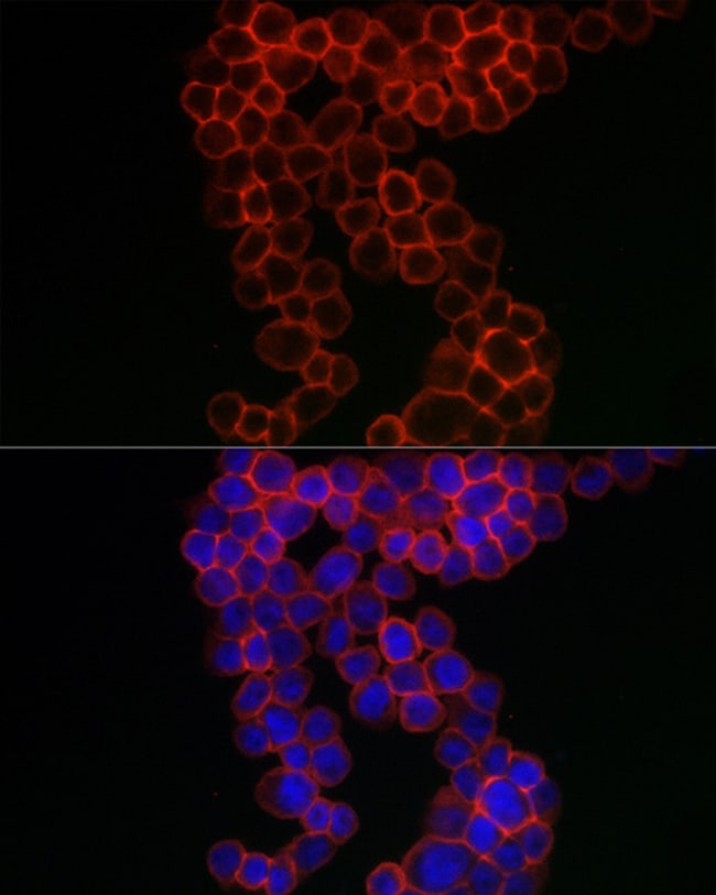 100UL CD38 ANTIBODY 100 ul