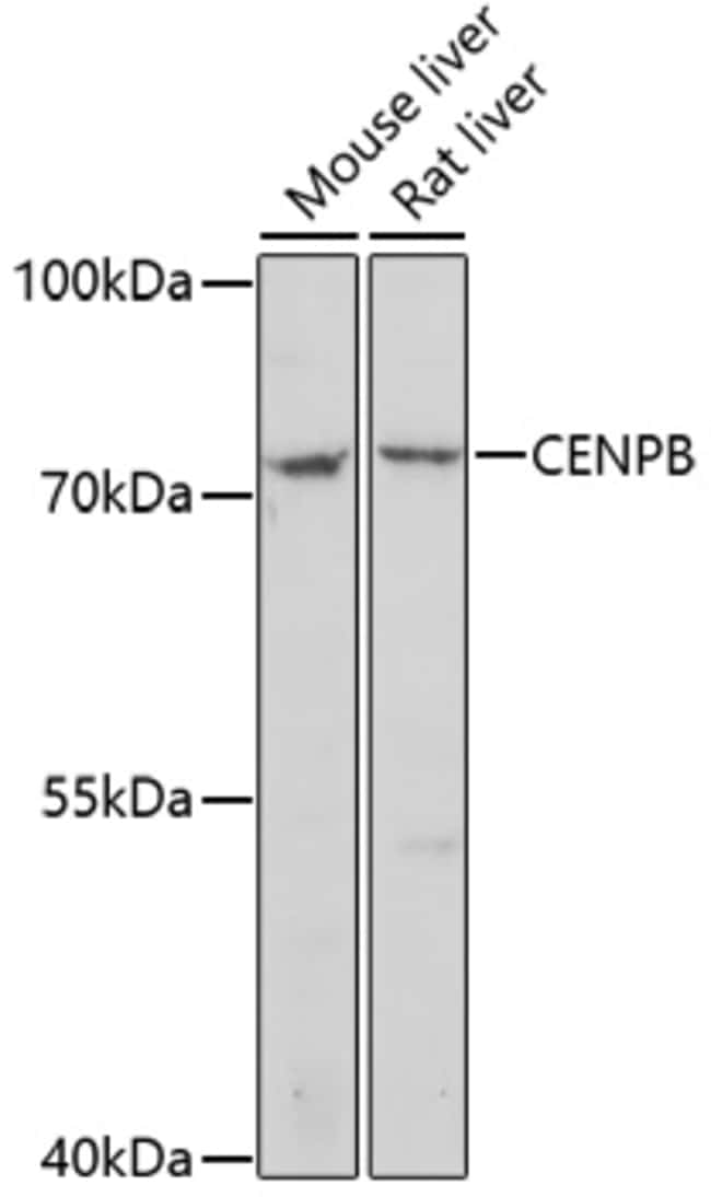 100UL CENPB ANTIBODY 100 ul