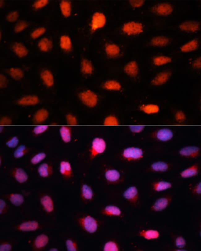 100UL CTBP2 ANTIBODY 100 ul