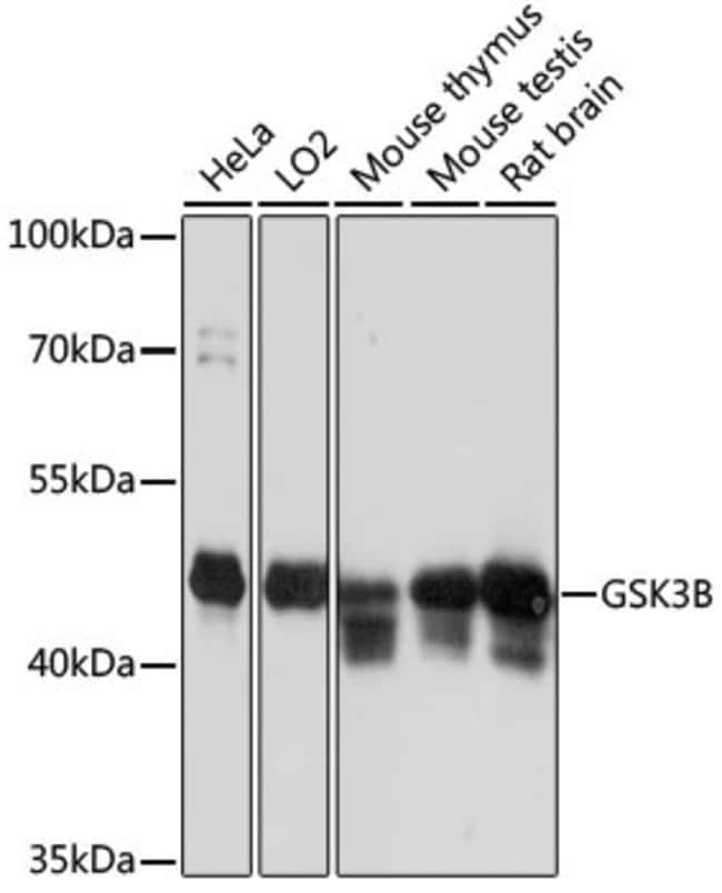 100UL GSK3B ANTIBODY 100 ul