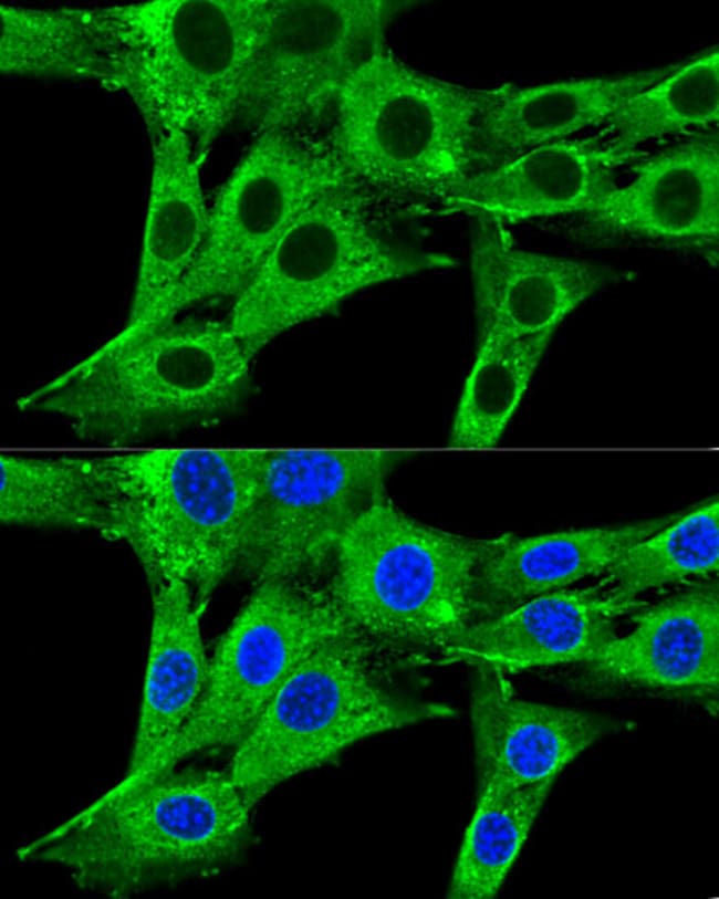 100UL HMGCR ANTIBODY 100 ul