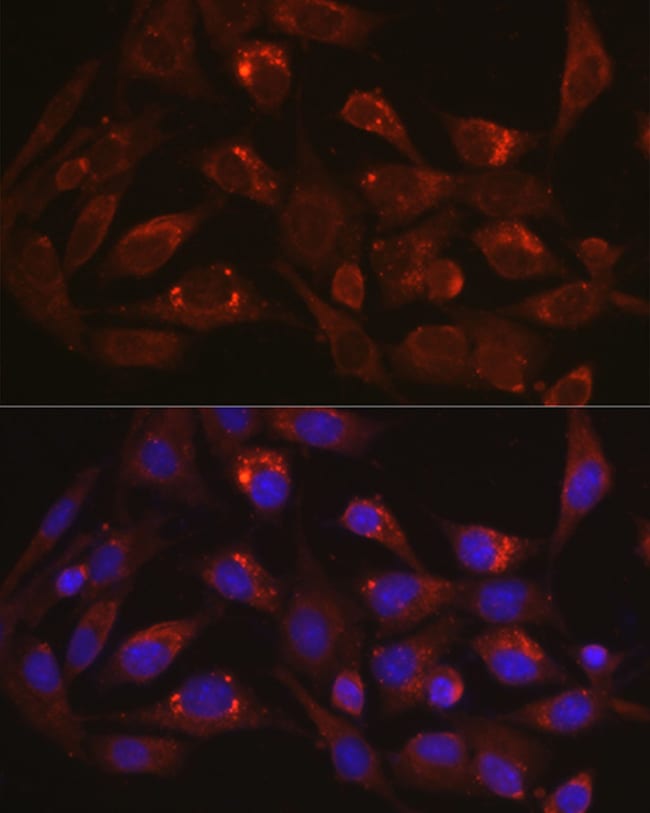 100 UL LAMP1 Polyclonal Antibody
