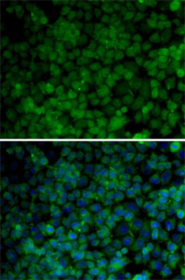 100UL CDK7 ANTIBODY 100 ul