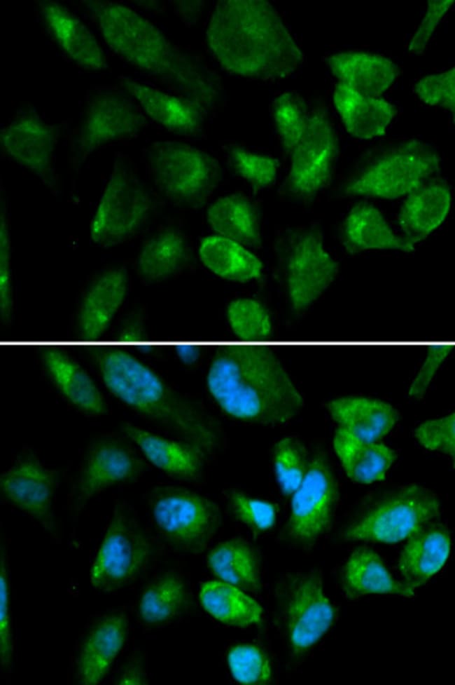 100UL KIR2DL3 ANTIBODY 100 ul