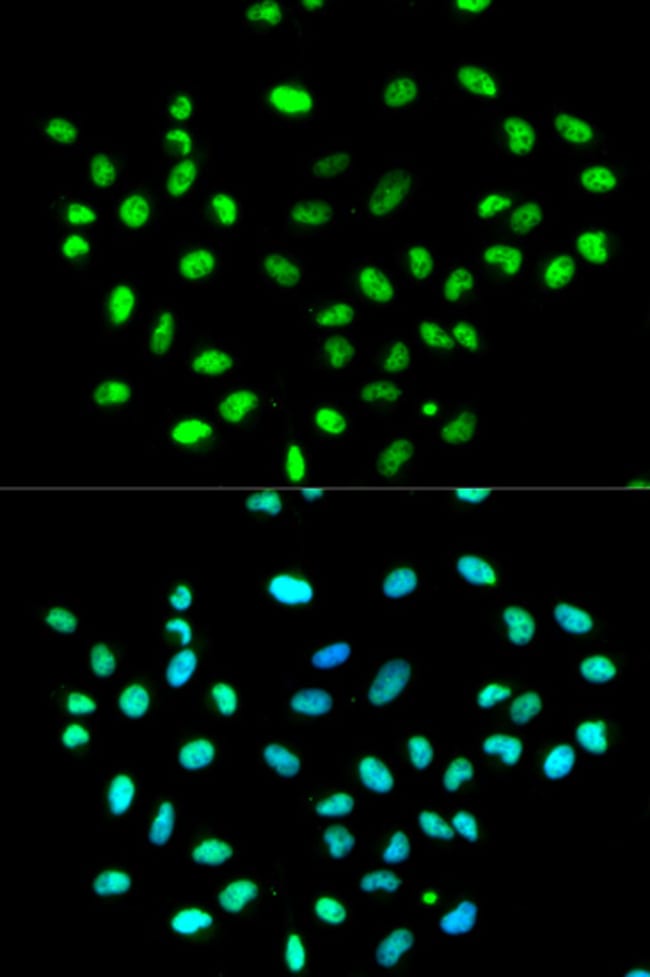 100UL HNRNP K ANTIBODY 100 ul