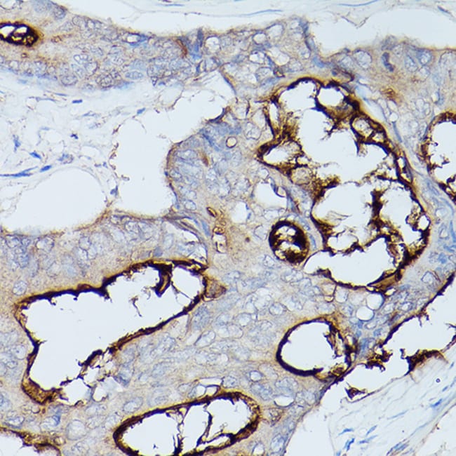 100UL CEACAM1 ANTIBODY 100 ul