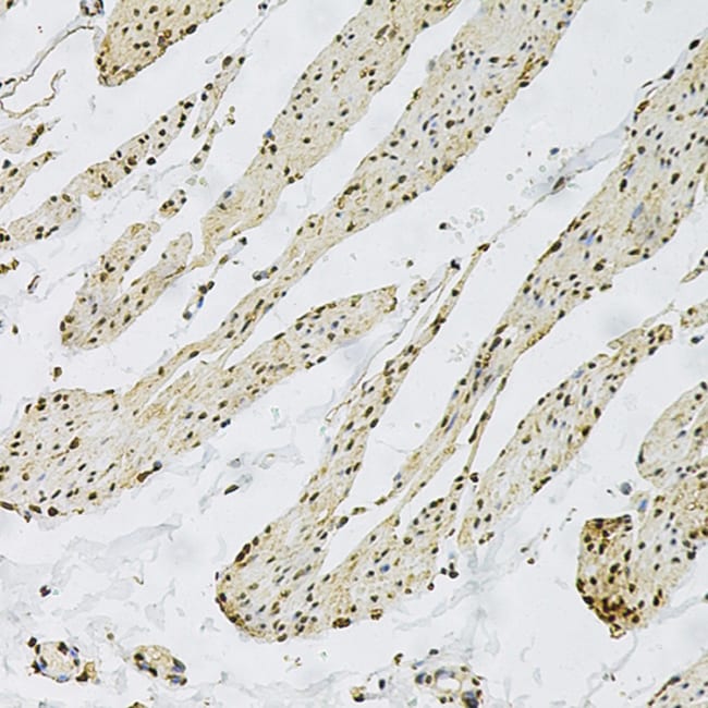 100UL CD9 ANTIBODY 100 ul
