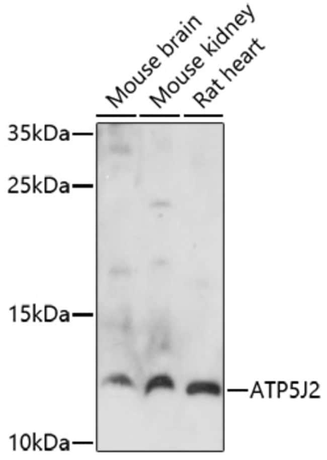100UL ATP5J2 ANTIBODY 100 ul