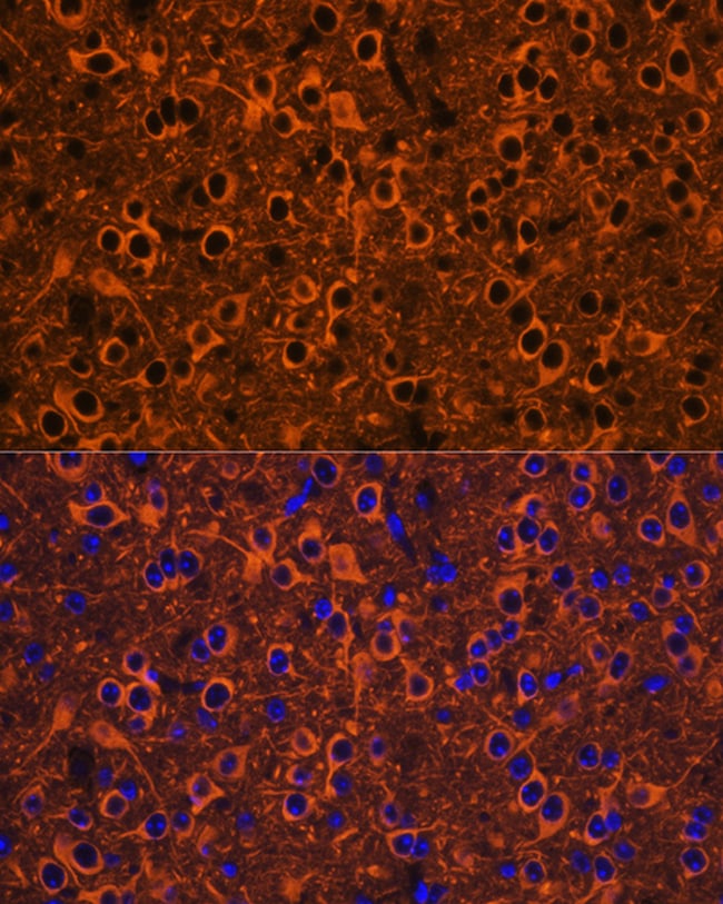 100UL BETA III TUBULIN ANTIBODY 100 ul