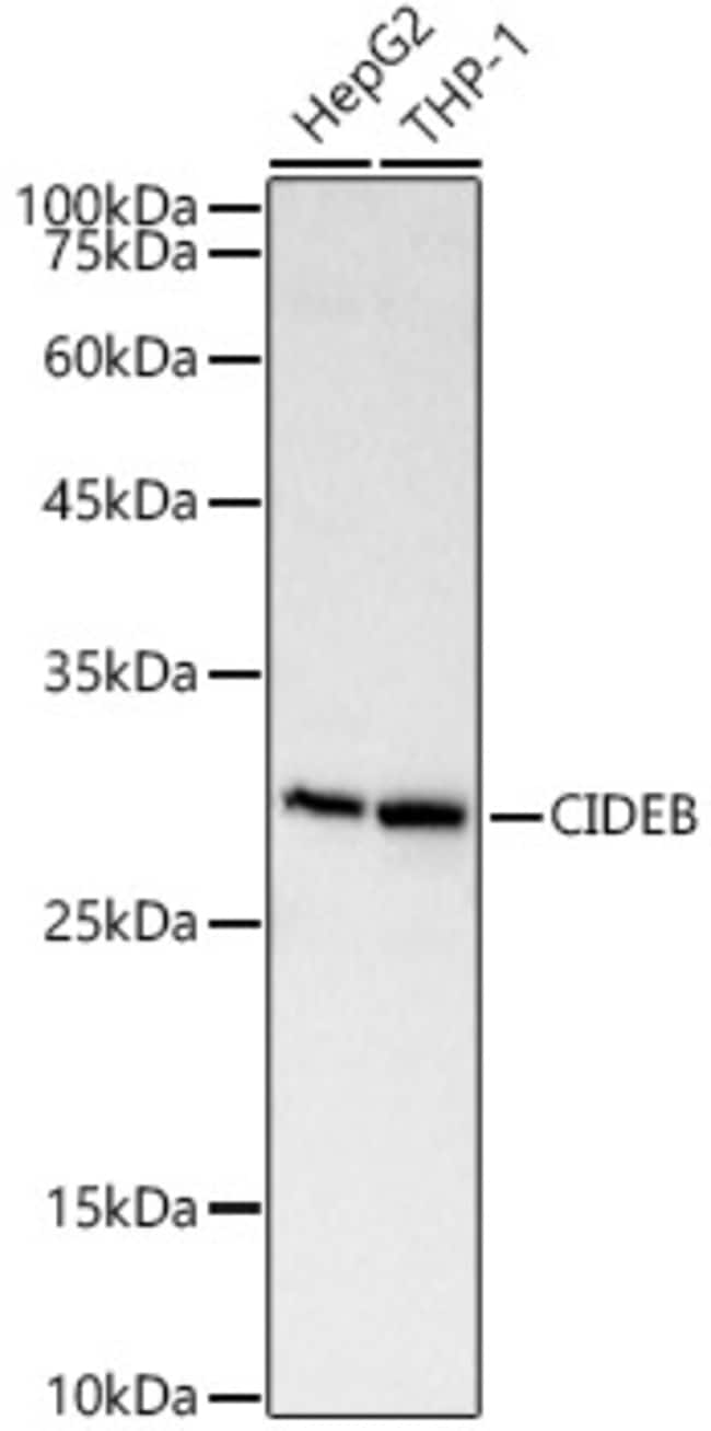 100UL CIDEB ANTIBODY 100 ul