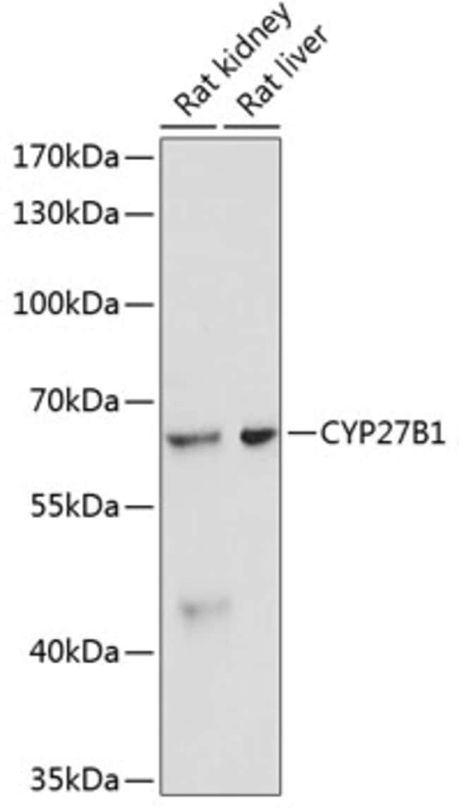 100UL CYP27B1 ANTIBODY 100 ul