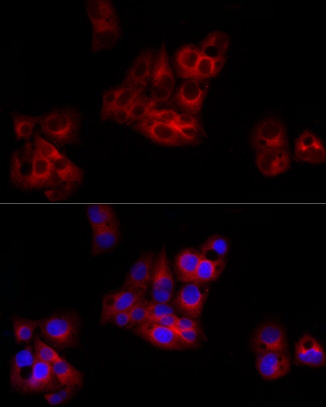 100UL C1 INHIBITOR ANTIBODY 100 ul