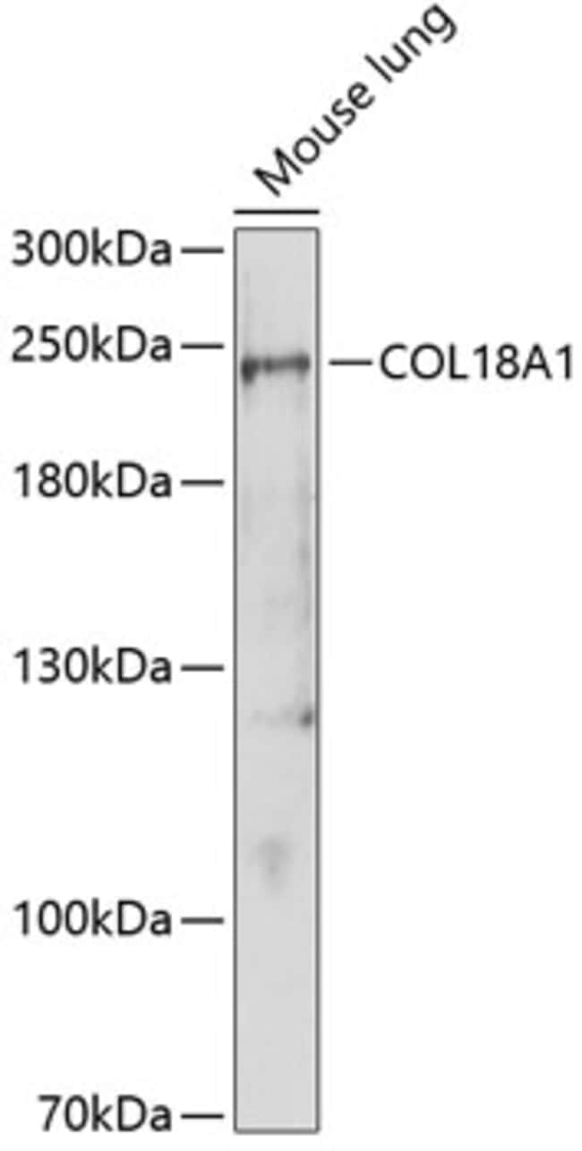 100UL ENDOSTATIN ANTIBODY 100 ul