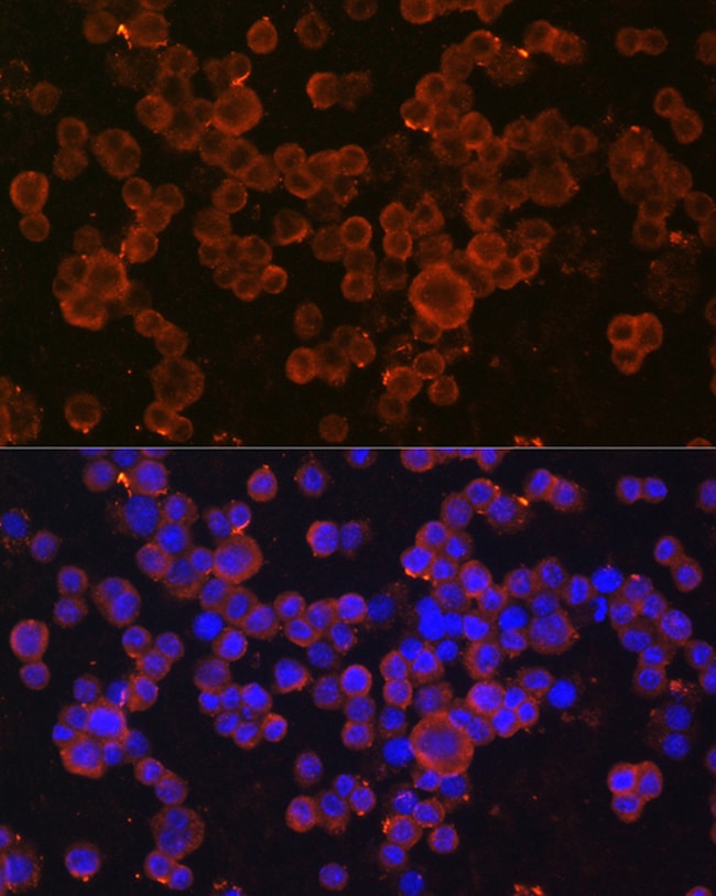 100UL CHI3L1 ANTIBODY 100 ul
