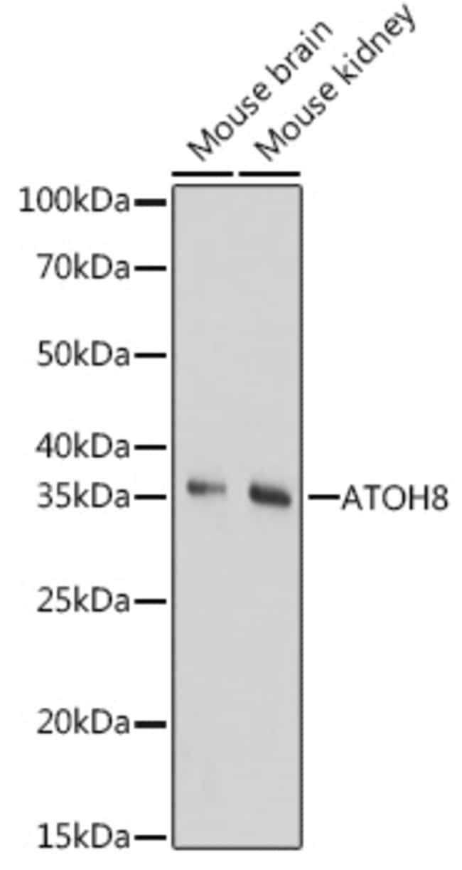 100UL ATOH8 ANTIBODY 100 ul