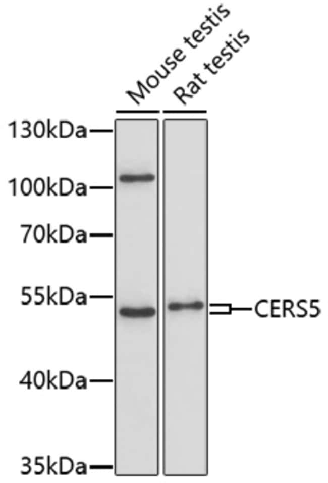 100UL LASS5 ANTIBODY 100 ul