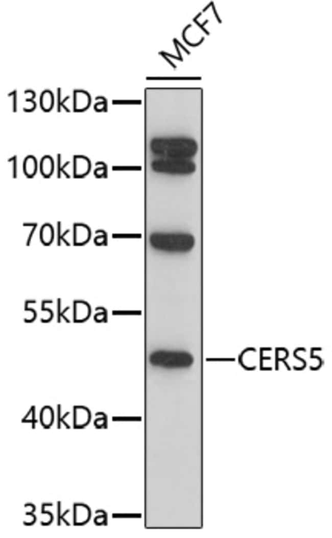 100UL LASS5 ANTIBODY 100 ul