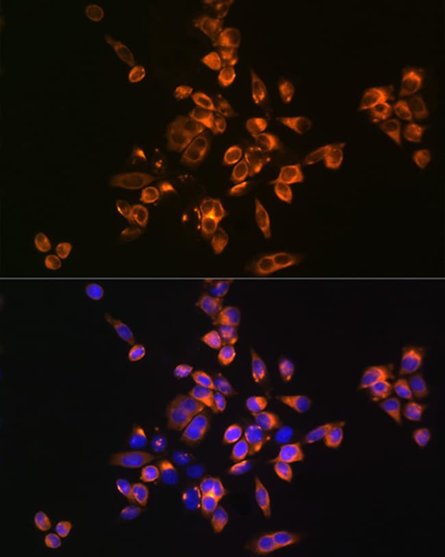 100UL ANNEXIN V ANTIBODY 100 ul