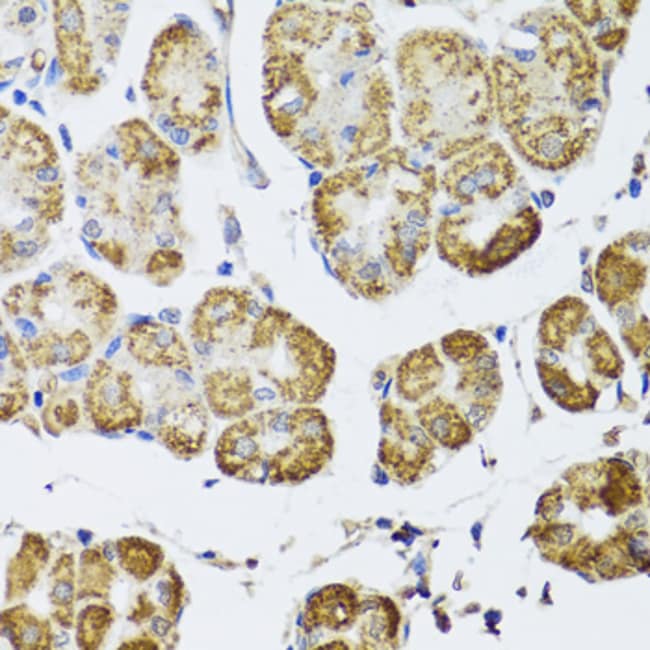 100UL HDAC6 ANTIBODY 100 ul