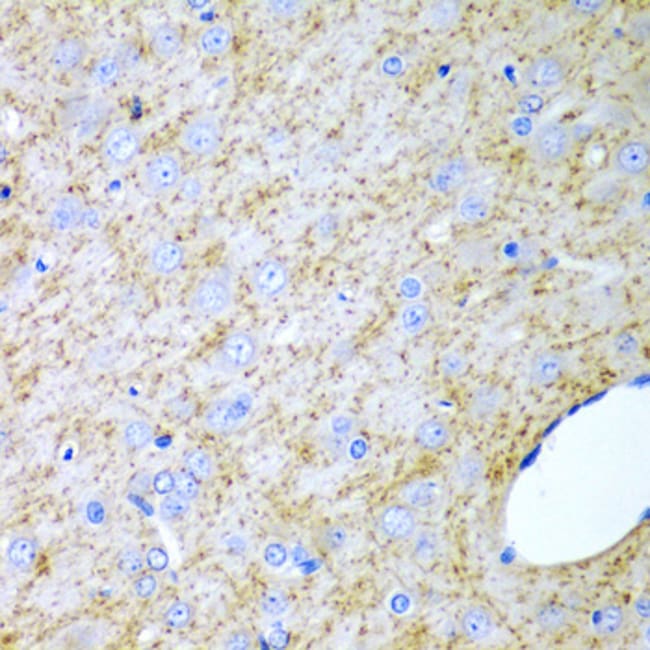 100UL INHA ANTIBODY 100 ul