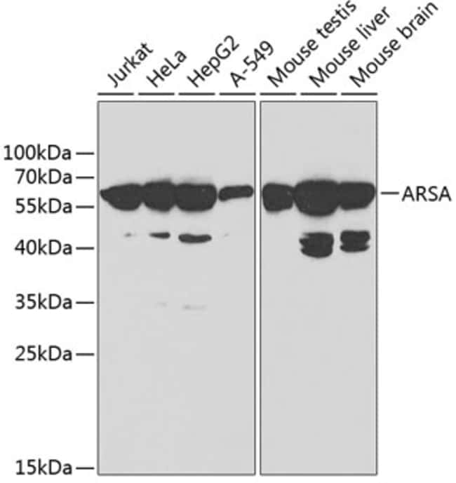 100UL ARSA ANTIBODY 100 ul