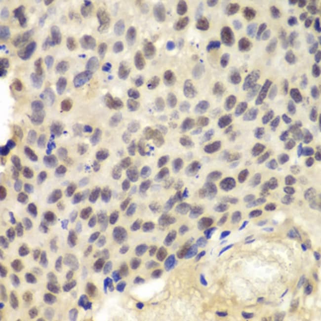 100UL KPNA1 ANTIBODY 100 ul