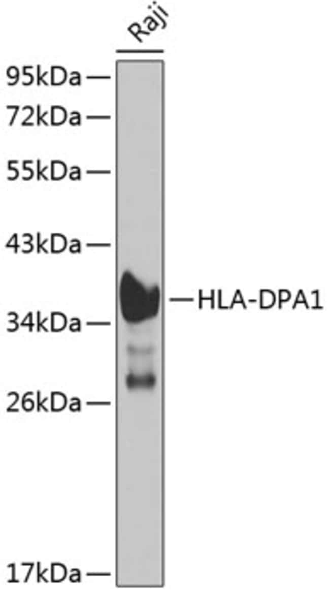 100UL HLA-DPA1 ANTIBODY 100 ul