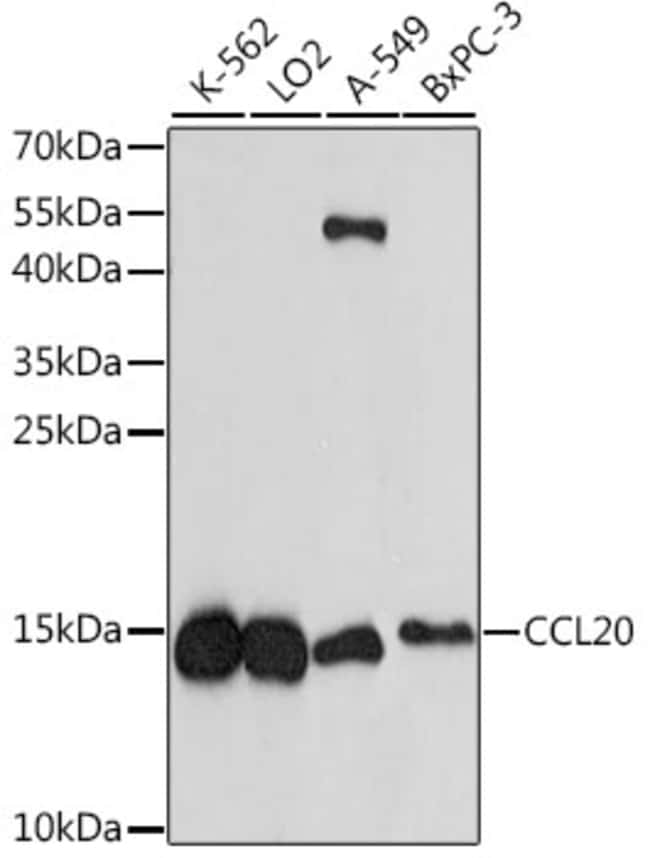 100UL CCL20 ANTIBODY 100 ul