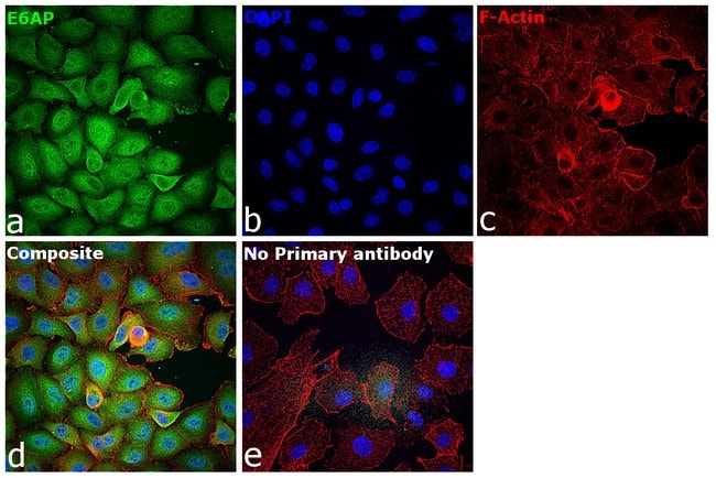 100UL E6AP ANTIBODY 100 ul