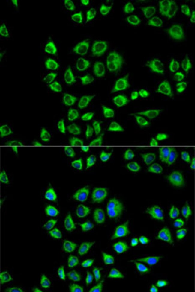 100UL CD1D ANTIBODY 100 ul