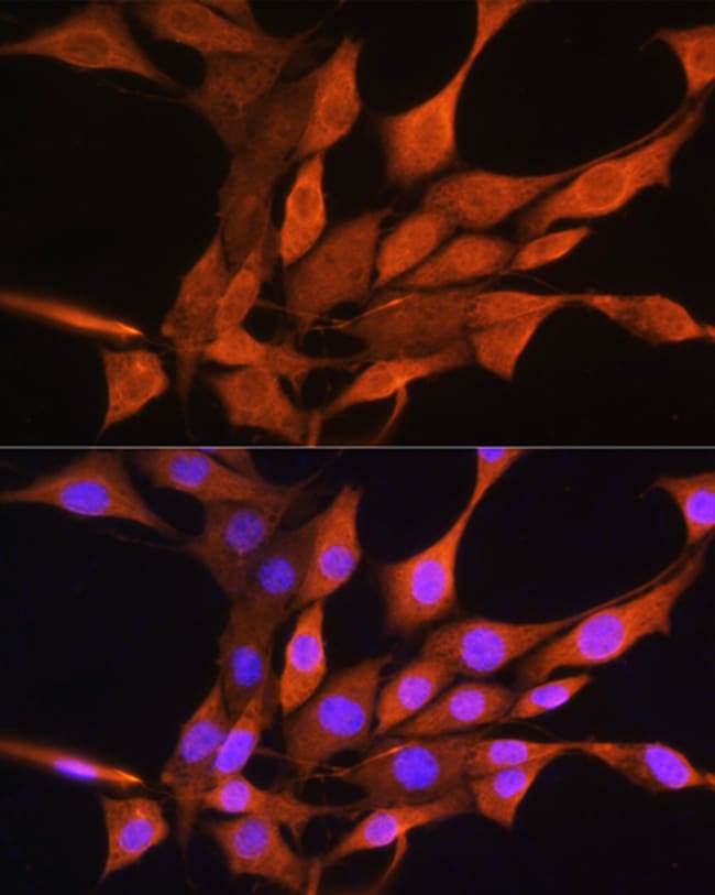 100UL AIRE ANTIBODY 100 ul