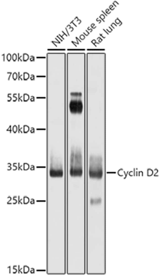 100UL CYCLIN D2 ANTIBODY 100 ul