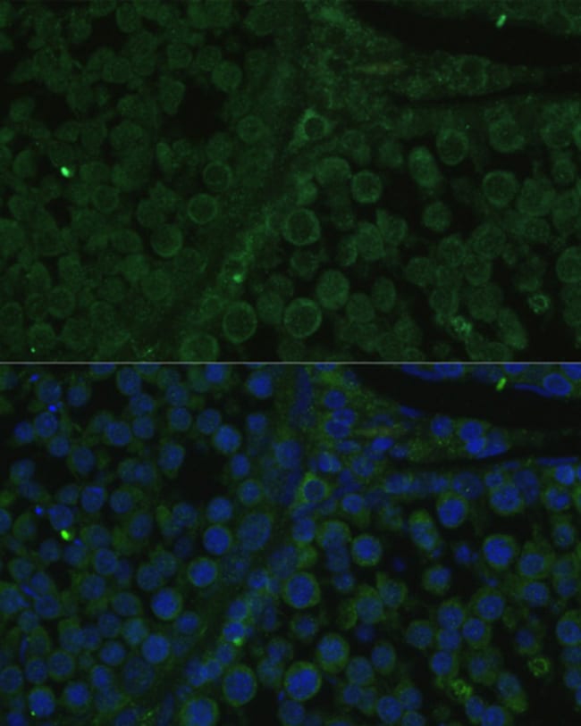 100UL IGF2BP2 ANTIBODY 100 ul