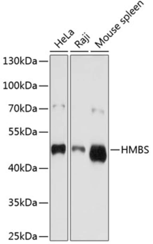 100UL HMBS ANTIBODY 100 ul
