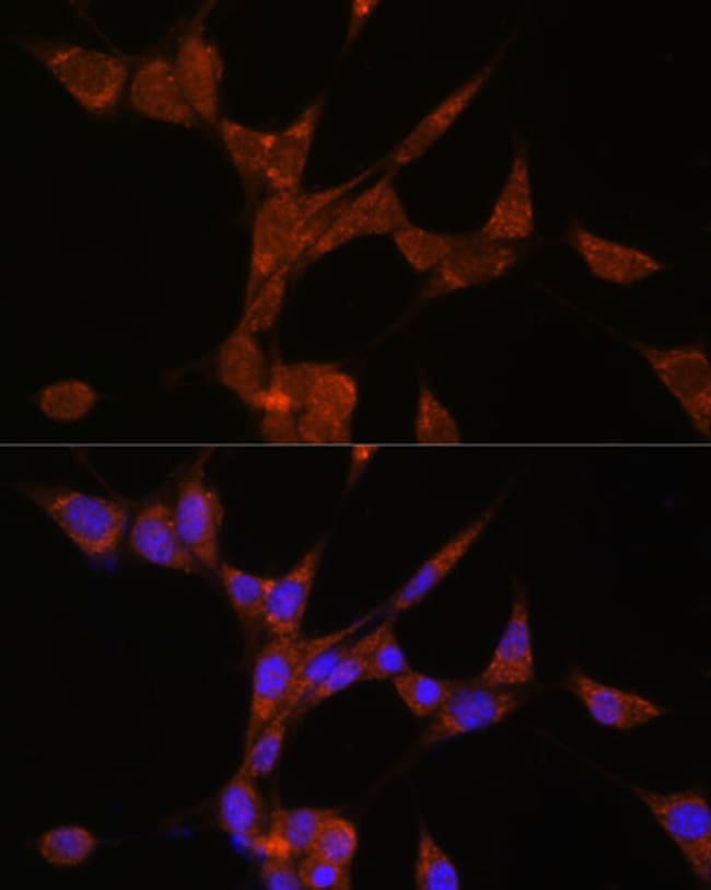 100UL AKR1C3 ANTIBODY 100 ul