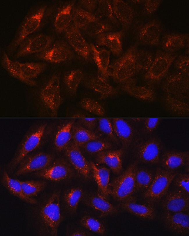100UL HGS ANTIBODY 100 ul