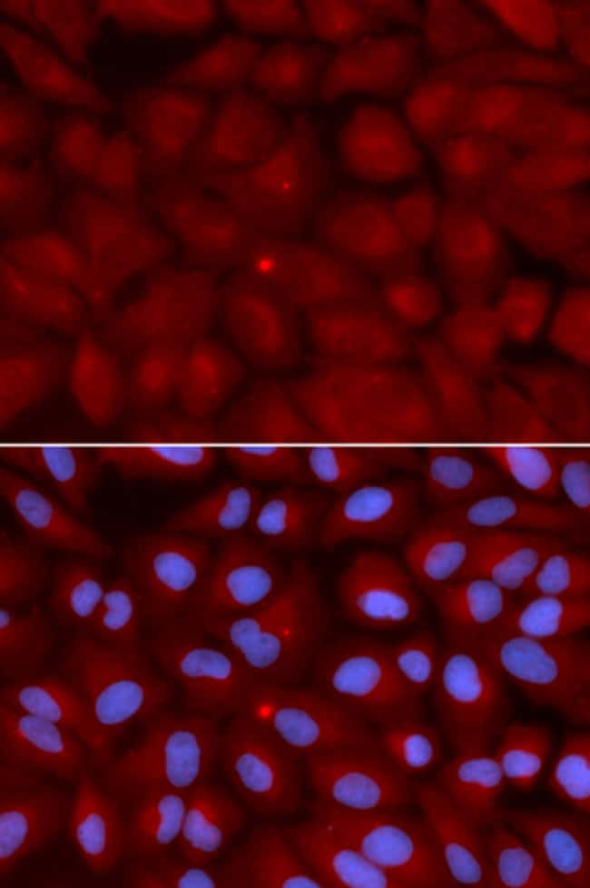 100UL BIN1 ANTIBODY 100 ul