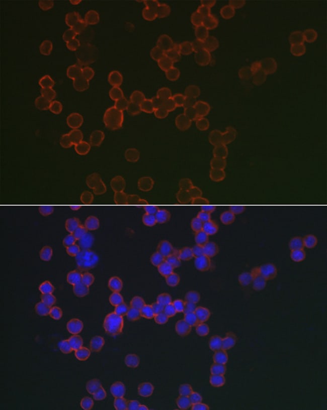 100UL CD20 ANTIBODY 100 ul
