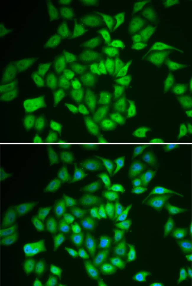 100UL CK1 EPSILON ANTIBODY 100 ul