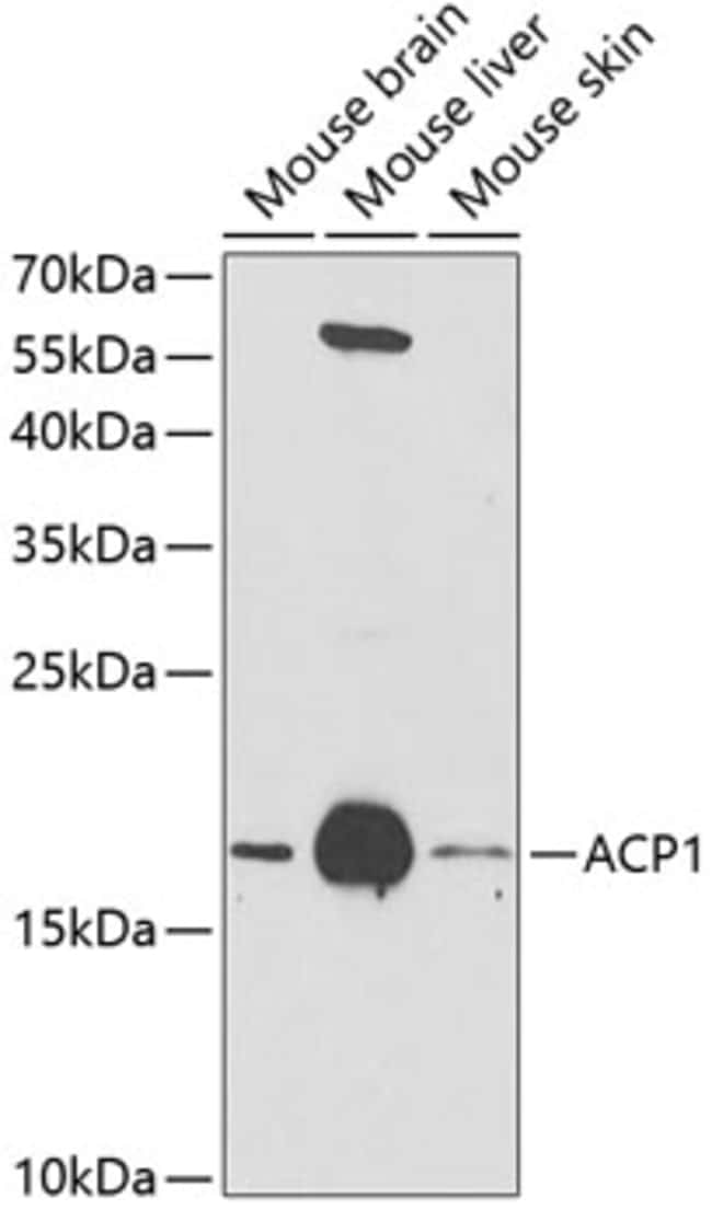 100UL ACID PHOSPHATASE 1 ANTIBODY 100 ul